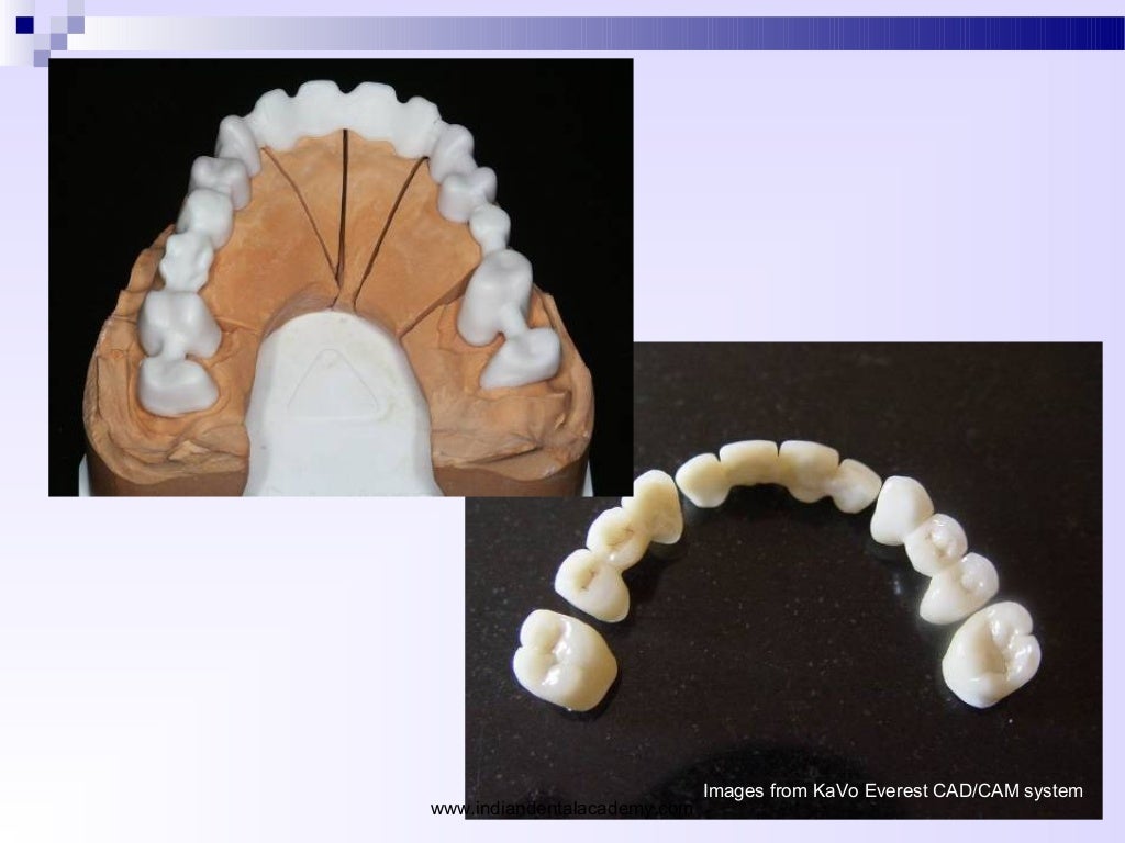 dental ceramics silicate ceramics and oxidceramics/ oral surgery cour…