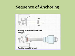 Sequence of Anchoring
 