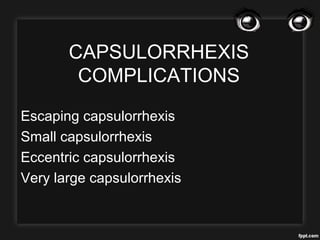 CAPSULORRHEXIS
COMPLICATIONS
Escaping capsulorrhexis
Small capsulorrhexis
Eccentric capsulorrhexis
Very large capsulorrhexis
 
