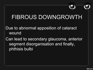 FIBROUS DOWNGROWTH
Due to abnormal apposition of cataract
wound
Can lead to secondary glaucoma, anterior
segment disorganisation and finally,
phthisis bulbi
 