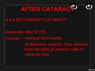 AFTER CATARACT
a.k.a SECONDARY CATARACT
Generally after ECCE
Causes: - residual lens matter
- proliferative cataract may develop
from remains of anterior cells in
capsular bag
 