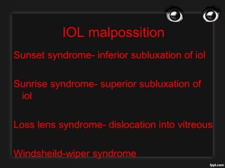 IOL malpossition
Sunset syndrome- inferior subluxation of iol
Sunrise syndrome- superior subluxation of
iol
Loss lens syndrome- dislocation into vitreous
Windsheild-wiper syndrome
 