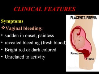 CLINICAL FEATURES
Symptoms
Vaginal bleeding:
• sudden in onset, painless
• revealed bleeding (fresh blood)
• Bright red or dark colored
• Unrelated to activity
 