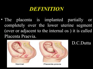 DEFINITION
• The placenta is implanted partially or
completely over the lower uterine segment
(over or adjacent to the internal os ) it is called
Placenta Praevia.
D.C.Dutta
 
