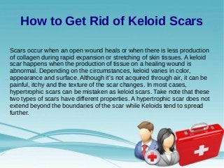 How to Get Rid of Keloid Scars
Scars occur when an open wound heals or when there is less production
of collagen during rapid expansion or stretching of skin tissues. A keloid
scar happens when the production of tissue on a healing wound is
abnormal. Depending on the circumstances, keloid varies in color,
appearance and surface. Although it's not acquired through air, it can be
painful, itchy and the texture of the scar changes. In most cases,
hypertrophic scars can be mistaken as keloid scars. Take note that these
two types of scars have different properties. A hypertrophic scar does not
extend beyond the boundaries of the scar while Keloids tend to spread
further.
 