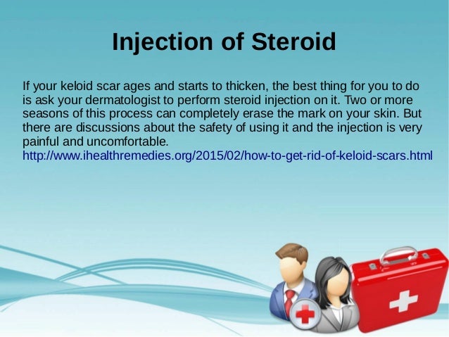 how to get rid of keloid scars at home