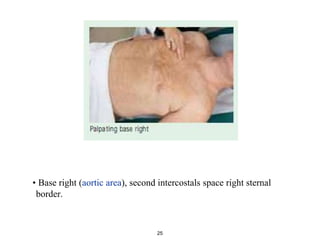 • Base right (aortic area), second intercostals space right sternal
border.
25
 