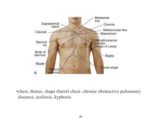 •chest, thorax, shape (barrel chest- chronic obstructive pulmonary
disease), scoliosis, kyphosis
29
 