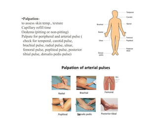 •Palpation-
to assess skin temp., texture
Capillary refill time
Oedema (pitting or non-pitting)
Palpate for peripheral and arterial pulse (
check for temporal, carotid pulse,
brachial pulse, radial pulse, ulnar,
femoral pulse, popliteal pulse, posterior
tibial pulse, dorsalis pedis pulse)
35
 