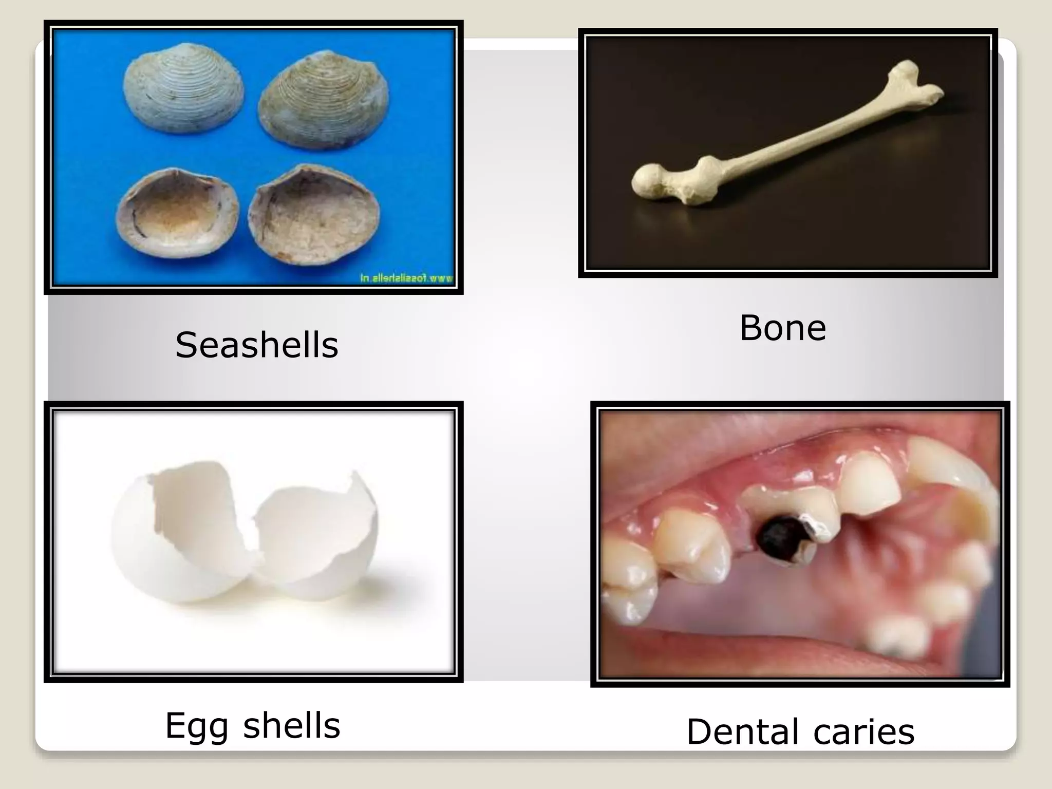 Seashells Bone
Egg shells Dental caries