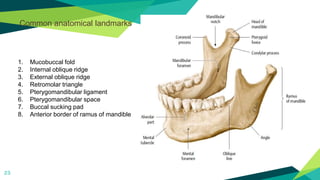 23
Common anatomical landmarks
1. Mucobuccal fold
2. Internal oblique ridge
3. External oblique ridge
4. Retromolar triangle
5. Pterygomandibular ligament
6. Pterygomandibular space
7. Buccal sucking pad
8. Anterior border of ramus of mandible
 