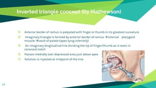 Inverted triangle concept (by Mathewson)
 Anterior border of ramus is palpated with finger or thumb in its greatest curvature
 Imaginary triangle is formed by anterior border of ramus internal pterygoid
muscle vault of palate (apex lying inferiorly)
 An imaginary longitudinal line dividing the tip of finger/thumb as it rests in
coronoid notch
 Passes medially over depressed area just above apex
 Solution is injected at midpoint of the line
28
 