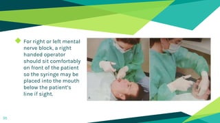 ◆ For right or left mental
nerve block, a right
handed operator
should sit comfortably
on front of the patient
so the syringe may be
placed into the mouth
below the patient’s
line if sight.
35
 
