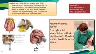 41
Landmarks:
Infra orbital Notch,
Mucobuccal fold,
Infra orbital Foramen
Feel the infra orbital notch moving your finger
down the notch palpating the tissues gently; the
outward bulge is the lower border of the orbit
which is the roof of the infra orbital foramen;
continue the finger inferiorly until a depression
is felt which is the infra orbital foramen
 