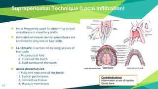 Supraperiostial Technique (Local Infiltration)
◆ Most frequently used for obtaining pulpal
anesthesia in maxillary teeth.
◆ Indicated whenever dental procedures are
confined to only one or two teeth.
◆ Landmark: insertion 45 to Long acsses of
the tooth
1. Mucobuccal fold.
2. Crown of the tooth.
3. Root contour of the tooth
◆ Areas Anesthetized
1. Pulp and root area of the tooth.
2. Buccal periosteum.
3. Connective tissue.
4. Mucous membrane
43
Contraindications
Inflammation at site of injection
Dense bone
 