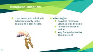 Intrapulpal Injection:
◆ Local anesthetic solution is
delivered directly to the
pulp using a bent needle.
◆ Advantages:
◆ Requires minimum
volumes of LA solution
◆ Immediate onset of
action
◆ Very few post operative
complications
51
 