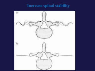 Increase spinal stability
 