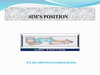 SIM’S POSITION
It is also called lateral recumbent position.
 