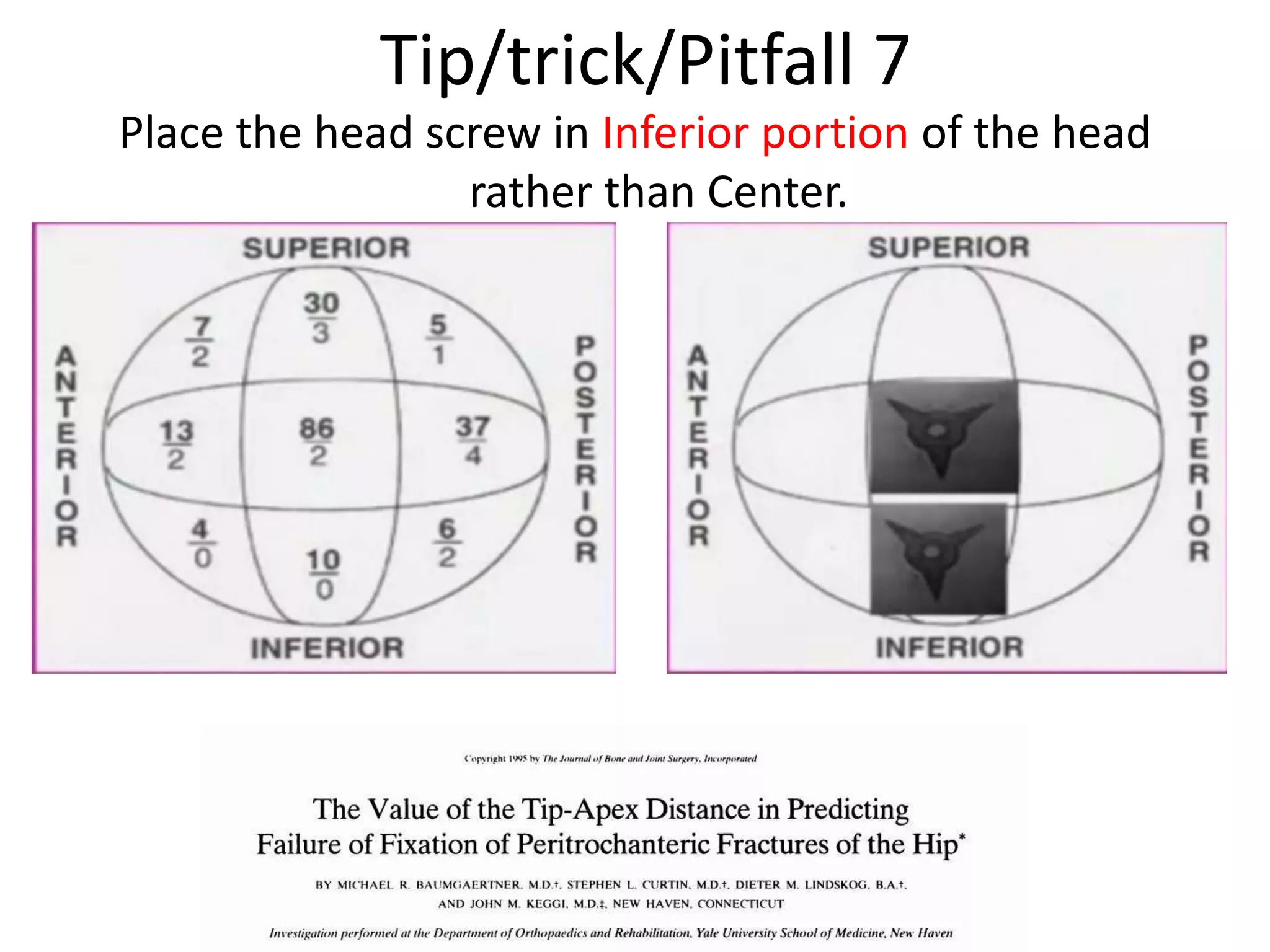 Tip/trick/Pitfall 7
Place the head screw in Inferior portion of the head
rather than Center.
 