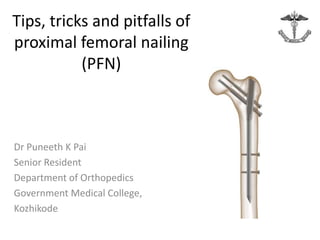 Tips, tricks and pitfalls of proximal femoral nailing (PFN)