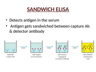 SANDWICH ELISA
• Detects antigen in the serum
• Antigen gets sandwiched between capture Ab
& detector antibody
 