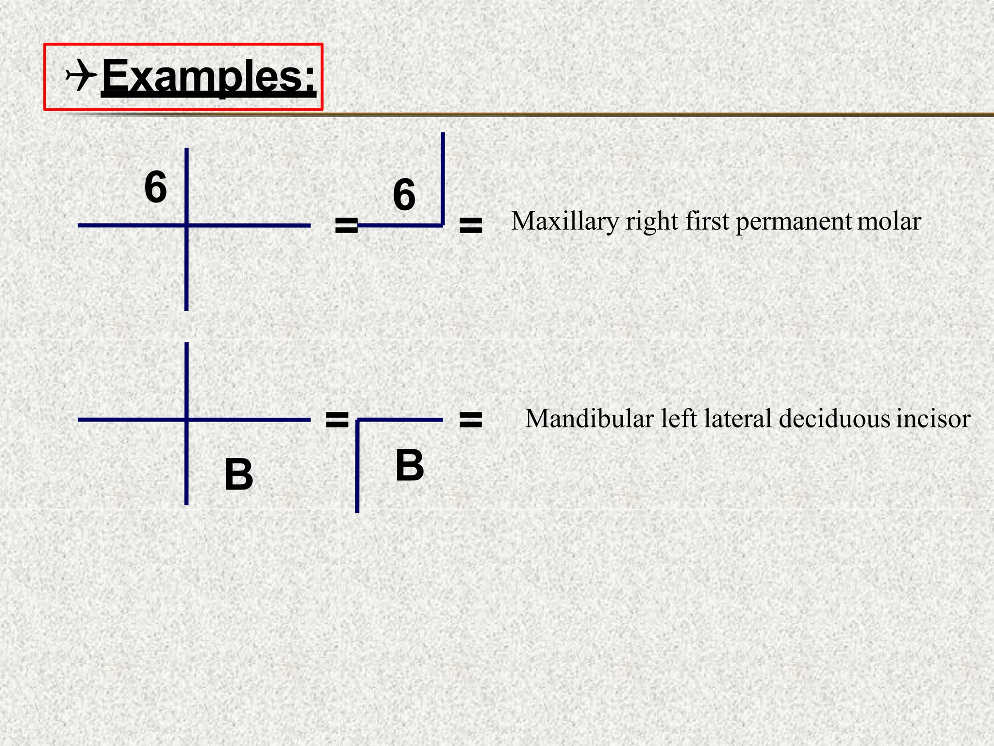 6
=
6
= Maxillary right first permanent molar
B
=
B
= Mandibular left lateral deciduous incisor
Examples:
 