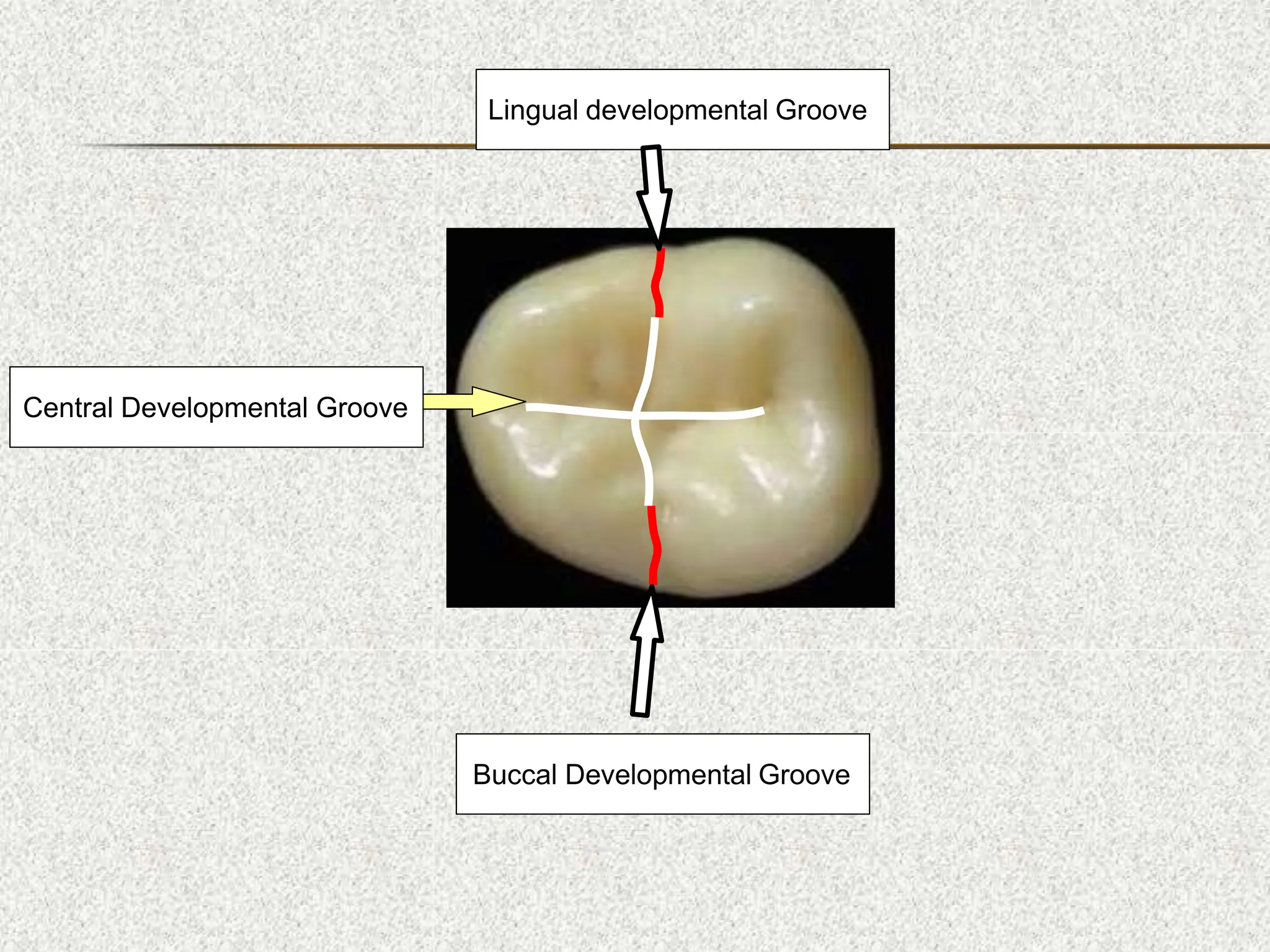 Central Developmental Groove
Lingual developmental Groove
Buccal Developmental Groove
 