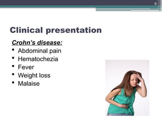 6
Clinical presentation
Crohn’s disease:
 Abdominal pain
 Hematochezia
 Fever
 Weight loss
 Malaise
 
