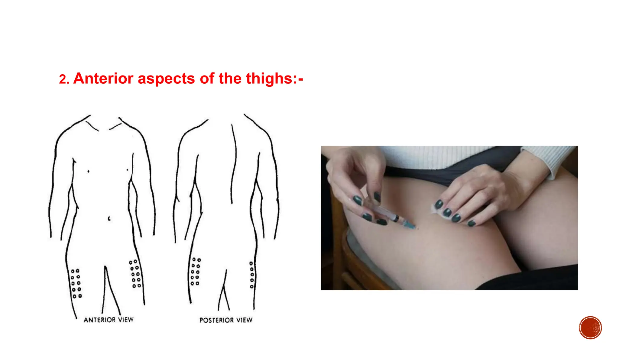 2. Anterior aspects of the thighs:-
 