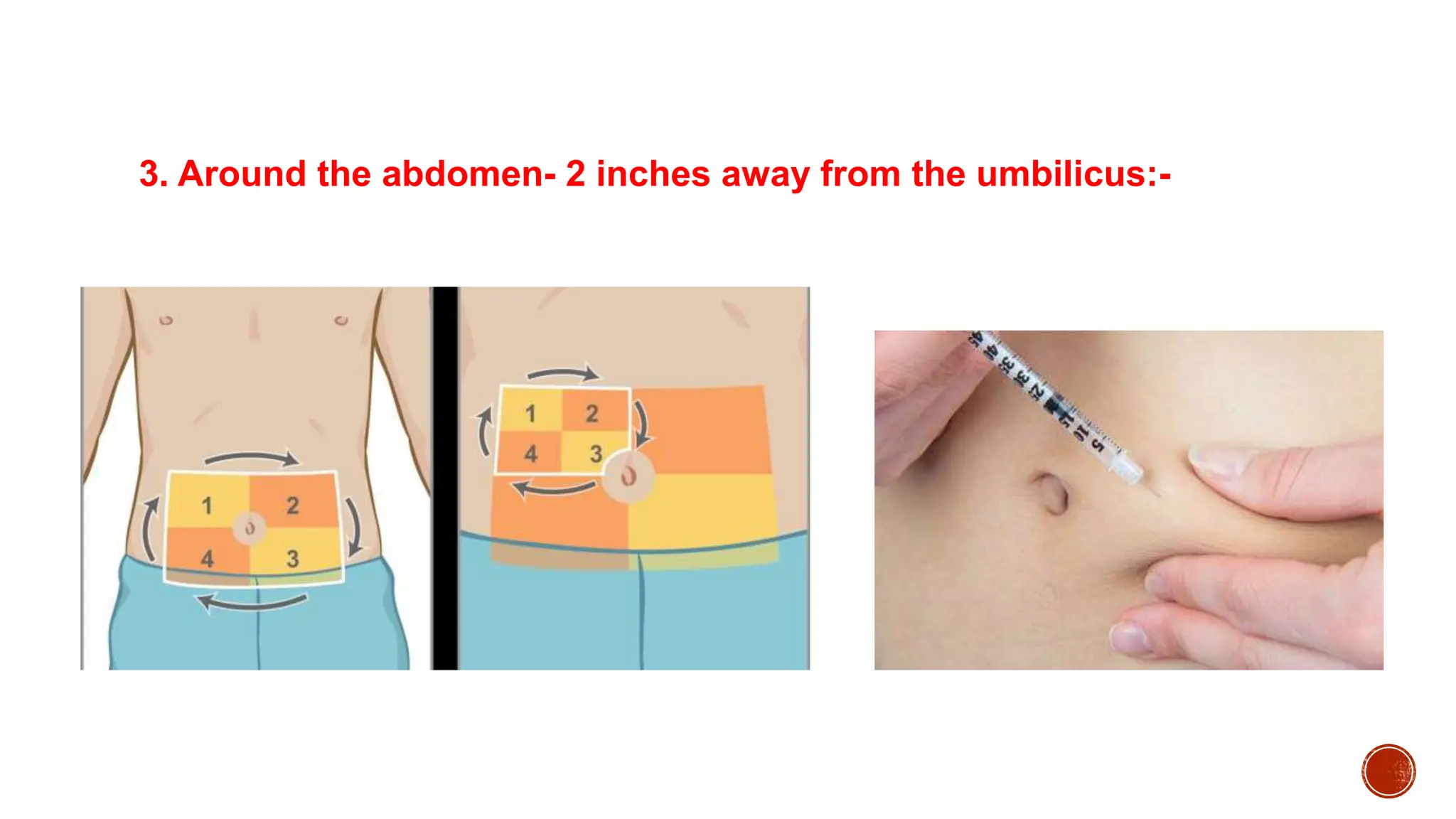 3. Around the abdomen- 2 inches away from the umbilicus:-
 