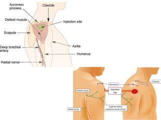 Ppt- axial and appendicular skeleton, injection sites | PPTX