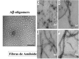 Fibras de Amiloide <1d 2d 1d 3d 7d 4d 