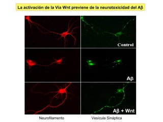 Neurofilamento Vesícula Sináptica A   + Wnt La activación de la Vía Wnt previene de la neurotoxicidad del A  
