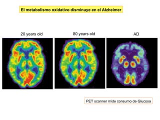 20 years old 80 years old AD PET scanner mide consumo   de Glucosa PET scanner El metabolismo oxidativo disminuye en el Alzheimer 