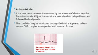 • Atrioventricular:
• It is a slow heart rate condition caused by the absence of electric impulse
from sinus mode. AV junction remains absence leads to delayed heartbeat
followed by bradycardia.
• This condition may be monitored through EKG and is appeared to be a
normal QRS complex accompanied with inverted P curve.
 