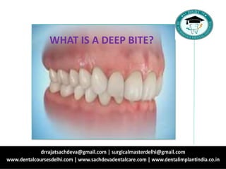 WHAT IS A DEEP BITE?
 