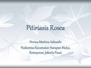 Pitiriasis Rosea
Devina Martina Adisusilo
Puskesmas Kecamatan Harapan Mulya,
Kemayoran, Jakarta Pusat
 
