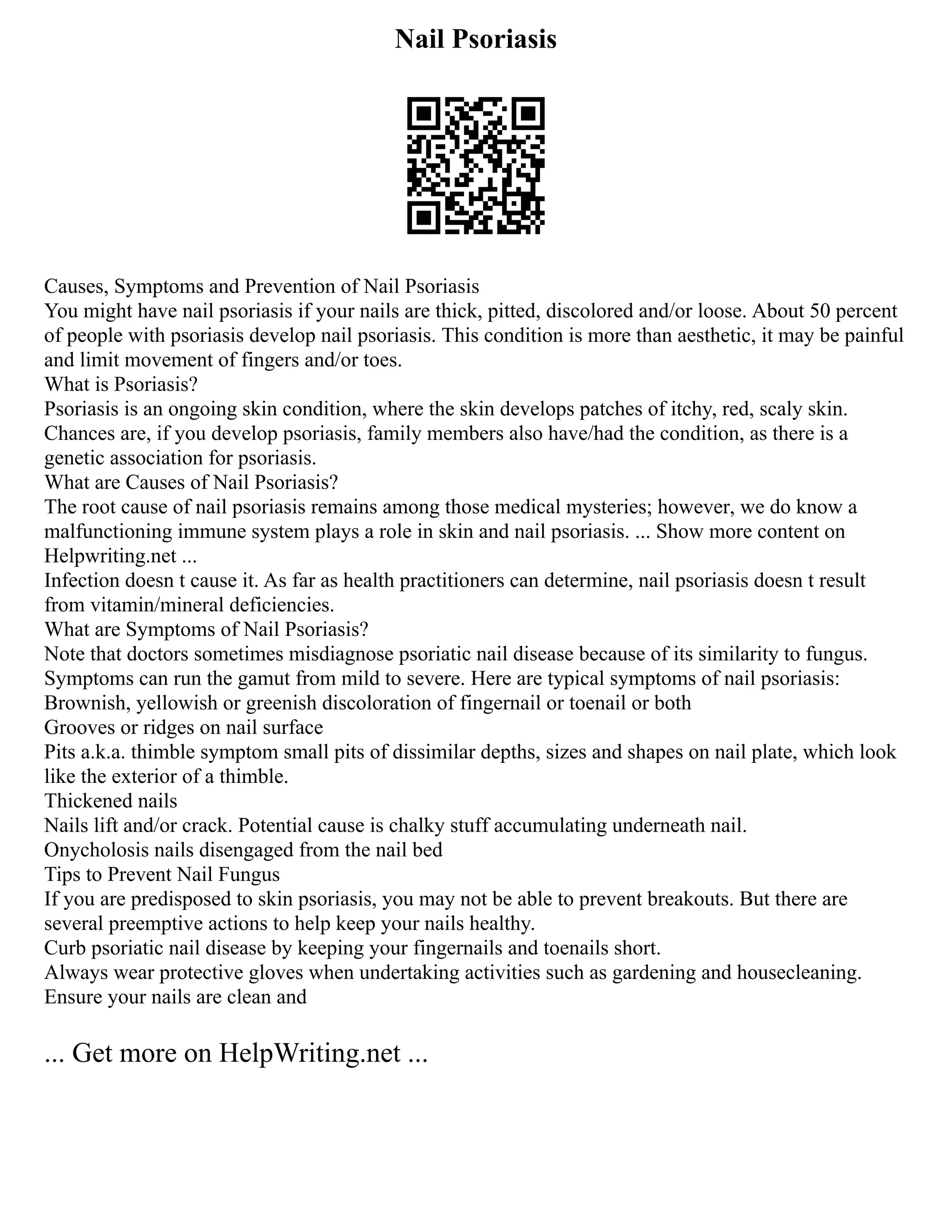 Nail Psoriasis
Causes, Symptoms and Prevention of Nail Psoriasis
You might have nail psoriasis if your nails are thick, pitted, discolored and/or loose. About 50 percent
of people with psoriasis develop nail psoriasis. This condition is more than aesthetic, it may be painful
and limit movement of fingers and/or toes.
What is Psoriasis?
Psoriasis is an ongoing skin condition, where the skin develops patches of itchy, red, scaly skin.
Chances are, if you develop psoriasis, family members also have/had the condition, as there is a
genetic association for psoriasis.
What are Causes of Nail Psoriasis?
The root cause of nail psoriasis remains among those medical mysteries; however, we do know a
malfunctioning immune system plays a role in skin and nail psoriasis. ... Show more content on
Helpwriting.net ...
Infection doesn t cause it. As far as health practitioners can determine, nail psoriasis doesn t result
from vitamin/mineral deficiencies.
What are Symptoms of Nail Psoriasis?
Note that doctors sometimes misdiagnose psoriatic nail disease because of its similarity to fungus.
Symptoms can run the gamut from mild to severe. Here are typical symptoms of nail psoriasis:
Brownish, yellowish or greenish discoloration of fingernail or toenail or both
Grooves or ridges on nail surface
Pits a.k.a. thimble symptom small pits of dissimilar depths, sizes and shapes on nail plate, which look
like the exterior of a thimble.
Thickened nails
Nails lift and/or crack. Potential cause is chalky stuff accumulating underneath nail.
Onycholosis nails disengaged from the nail bed
Tips to Prevent Nail Fungus
If you are predisposed to skin psoriasis, you may not be able to prevent breakouts. But there are
several preemptive actions to help keep your nails healthy.
Curb psoriatic nail disease by keeping your fingernails and toenails short.
Always wear protective gloves when undertaking activities such as gardening and housecleaning.
Ensure your nails are clean and
... Get more on HelpWriting.net ...
 