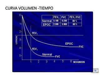 CURVA VOLUMEN -TIEMPO
 