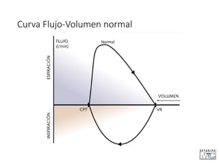 Curva Flujo-Volumen normal
 