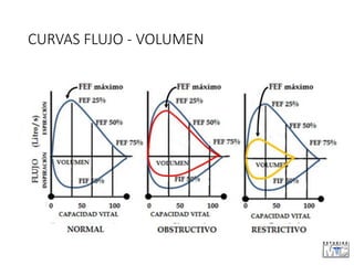 CURVAS FLUJO - VOLUMEN
 