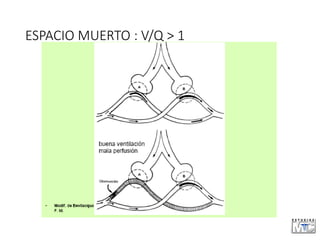 ESPACIO MUERTO : V/Q > 1
 