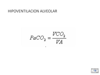 HIPOVENTILACION ALVEOLAR
 