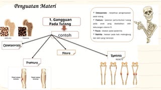 Kaki Rakhitis Comprehensive Overview of Disorders and Diseases Affecting the Human ...