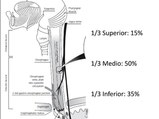1/3 Superior: 15%
1/3 Medio: 50%
1/3 Inferior: 35%
 