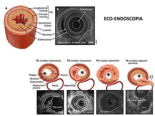 ECO-ENDOSCOPIA
 