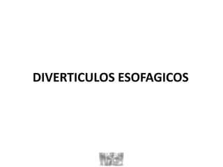 DIVERTICULOS ESOFAGICOS
 