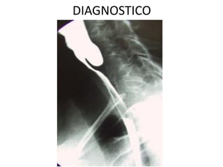 DIAGNOSTICO
 