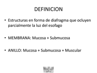 DEFINICION
• Estructuras en forma de diafragma que ocluyen
parcialmente la luz del esofago
• MEMBRANA: Mucosa + Submucosa
• ANILLO: Mucosa + Submucosa + Muscular
 
