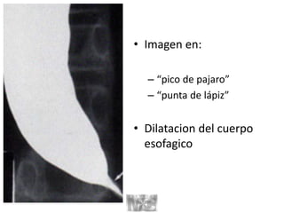• Imagen en:
– “pico de pajaro”
– “punta de lápiz”
• Dilatacion del cuerpo
esofagico
 
